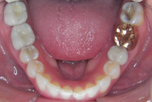 Orthodontic Patient 5