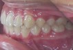 Orthodontic Patient 7