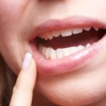 Correcting Your Bite - Align Orthodontics